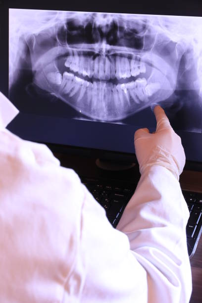 Emergency Dental Filling Replacement in NM
