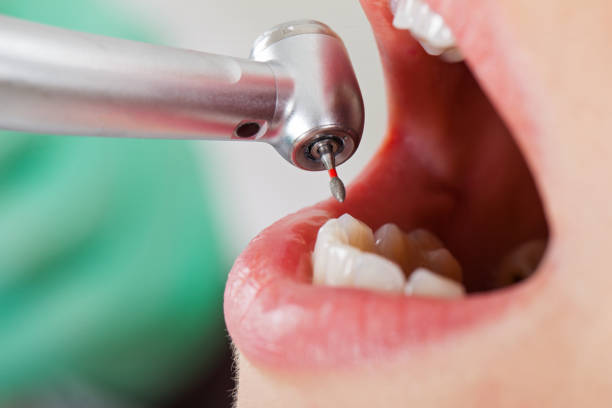 Best Dentist for Tooth Abscess  in Hurley, NM